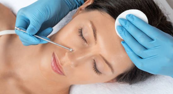 Limpieza facial profunda